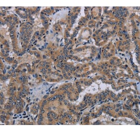 Immunohistochemistry - KLK8 Antibody from Signalway Antibody (36577) - Antibodies.com