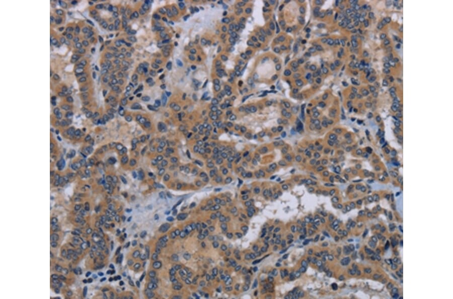 Immunohistochemistry - KLK8 Antibody from Signalway Antibody (36577) - Antibodies.com