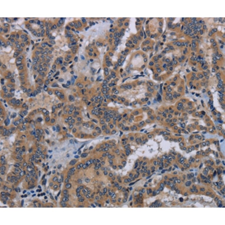 Immunohistochemistry - KLK8 Antibody from Signalway Antibody (36577) - Antibodies.com