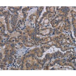 Immunohistochemistry - KLK8 Antibody from Signalway Antibody (36577) - Antibodies.com