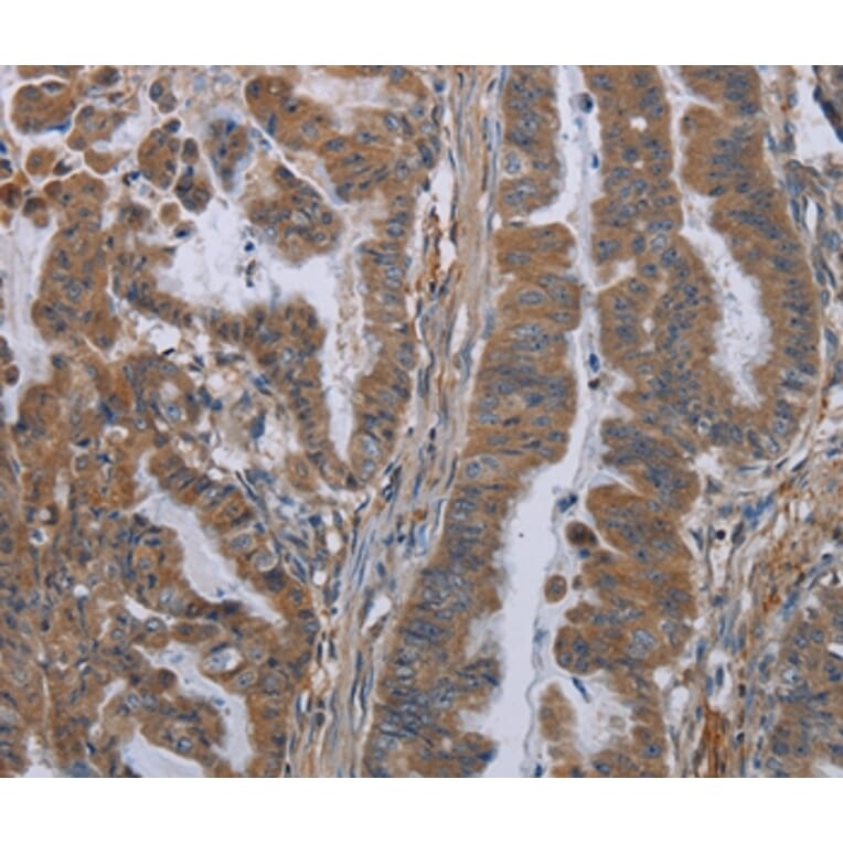 Immunohistochemistry - KLK8 Antibody from Signalway Antibody (36577) - Antibodies.com