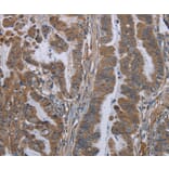 Immunohistochemistry - KLK8 Antibody from Signalway Antibody (36577) - Antibodies.com