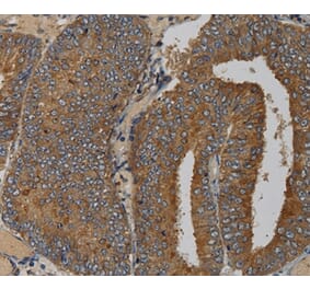 Immunohistochemistry - MAS1 Antibody from Signalway Antibody (36601) - Antibodies.com