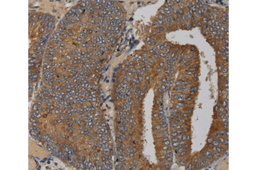 Immunohistochemistry - MAS1 Antibody from Signalway Antibody (36601) - Antibodies.com