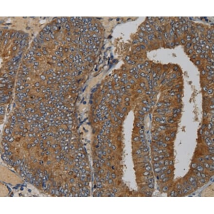 Immunohistochemistry - MAS1 Antibody from Signalway Antibody (36601) - Antibodies.com