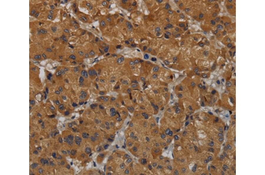 Immunohistochemistry - MAS1 Antibody from Signalway Antibody (36601) - Antibodies.com
