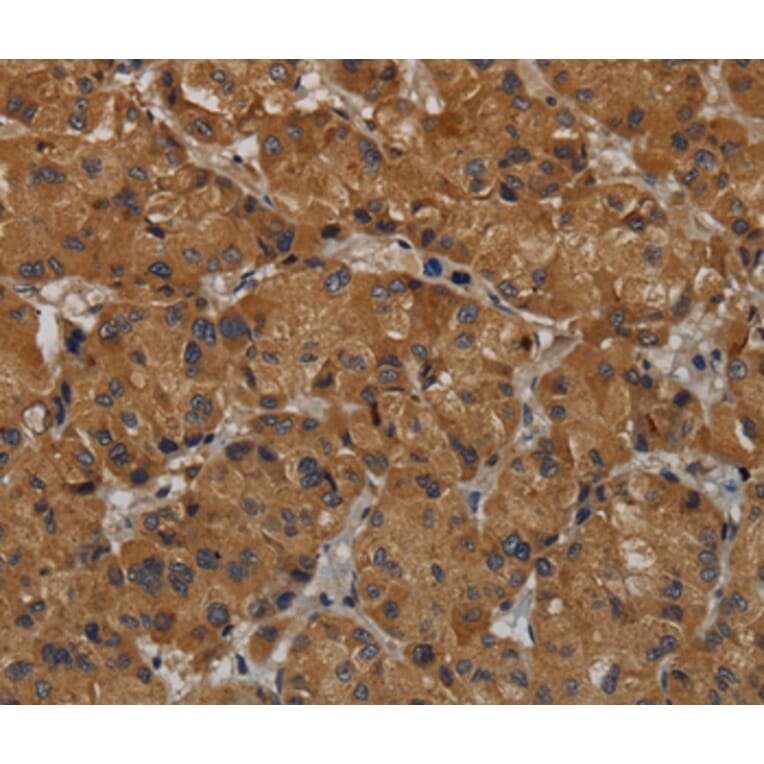 Immunohistochemistry - MAS1 Antibody from Signalway Antibody (36601) - Antibodies.com