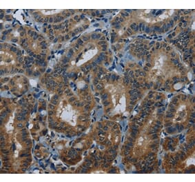 Immunohistochemistry - MEI1 Antibody from Signalway Antibody (36608) - Antibodies.com