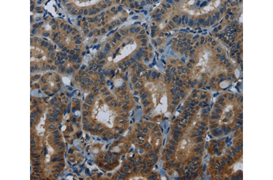 Immunohistochemistry - MEI1 Antibody from Signalway Antibody (36608) - Antibodies.com
