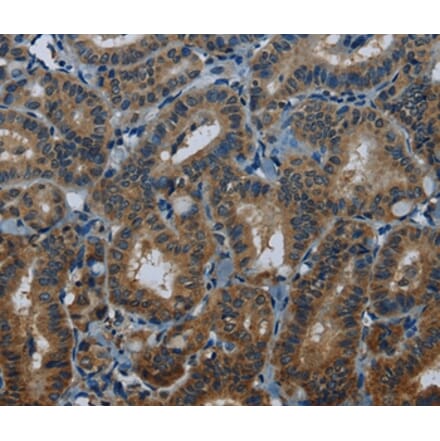 Immunohistochemistry - MEI1 Antibody from Signalway Antibody (36608) - Antibodies.com