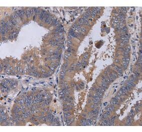 Immunohistochemistry - MKKS Antibody from Signalway Antibody (36619) - Antibodies.com