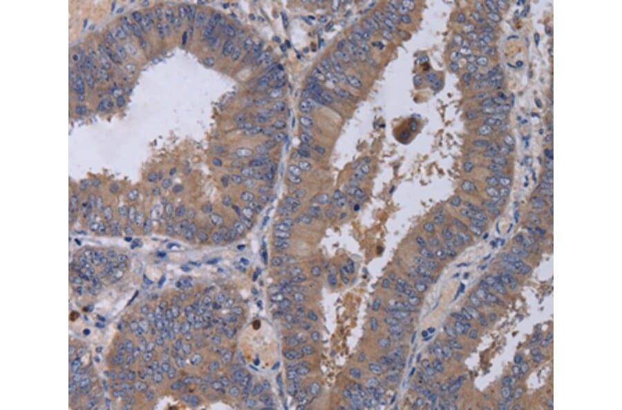 Immunohistochemistry - MKKS Antibody from Signalway Antibody (36619) - Antibodies.com