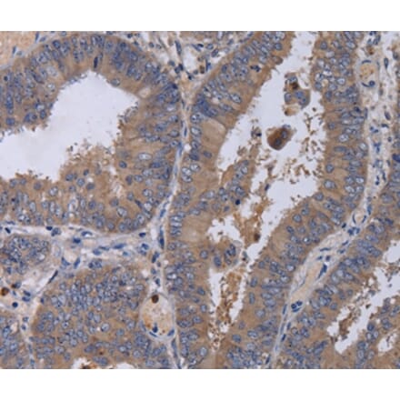 Immunohistochemistry - MKKS Antibody from Signalway Antibody (36619) - Antibodies.com