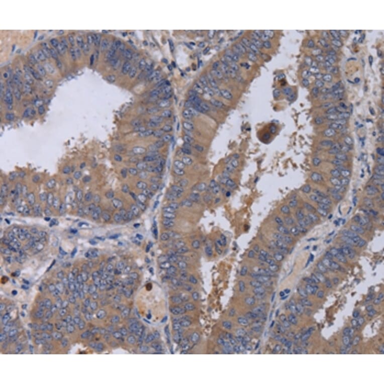 Immunohistochemistry - MKKS Antibody from Signalway Antibody (36619) - Antibodies.com