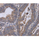 Immunohistochemistry - MKKS Antibody from Signalway Antibody (36619) - Antibodies.com