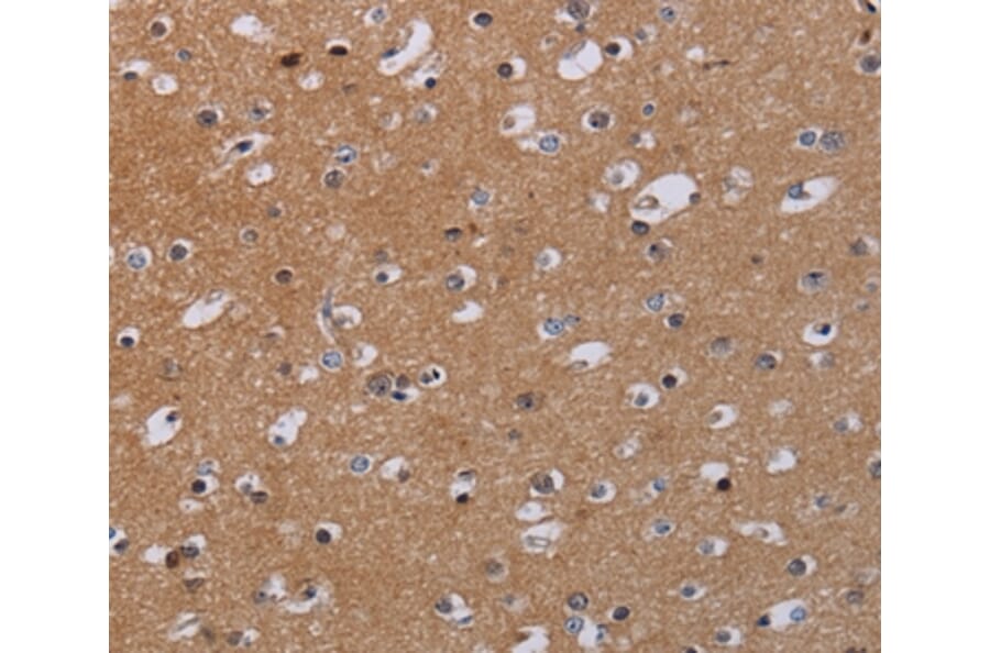 Immunohistochemistry - MKKS Antibody from Signalway Antibody (36619) - Antibodies.com