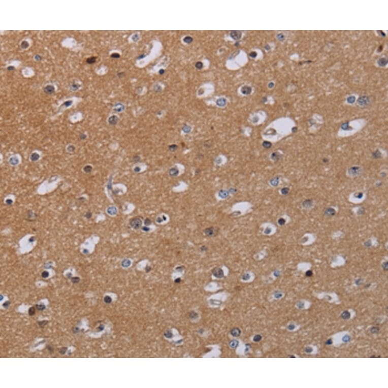 Immunohistochemistry - MKKS Antibody from Signalway Antibody (36619) - Antibodies.com