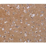 Immunohistochemistry - MKKS Antibody from Signalway Antibody (36619) - Antibodies.com