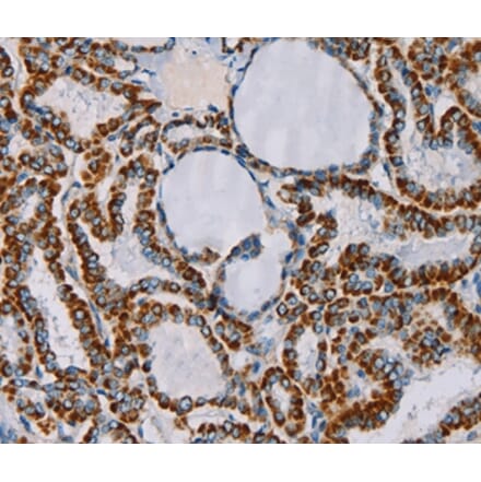 Immunohistochemistry - CMC4 Antibody from Signalway Antibody (36622) - Antibodies.com