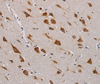 Immunohistochemical analysis of paraffin-embedded Human brain tissue using #36622 at dilution 1/55.