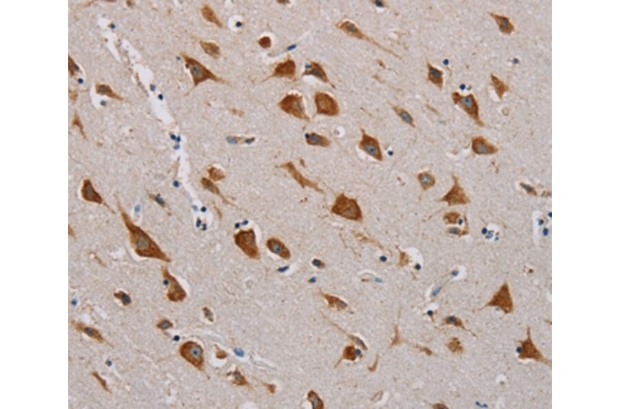 Immunohistochemistry - CMC4 Antibody from Signalway Antibody (36622) - Antibodies.com