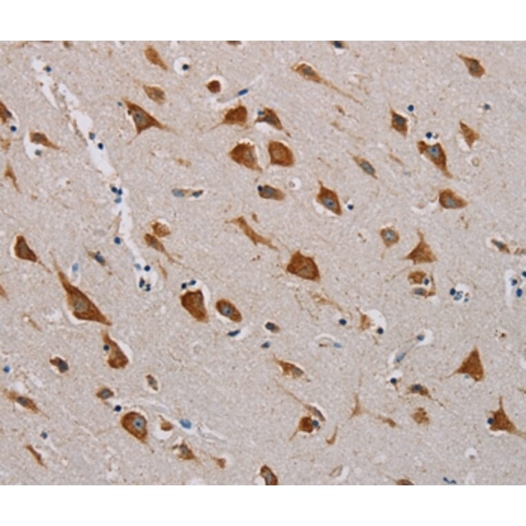 Immunohistochemistry - CMC4 Antibody from Signalway Antibody (36622) - Antibodies.com