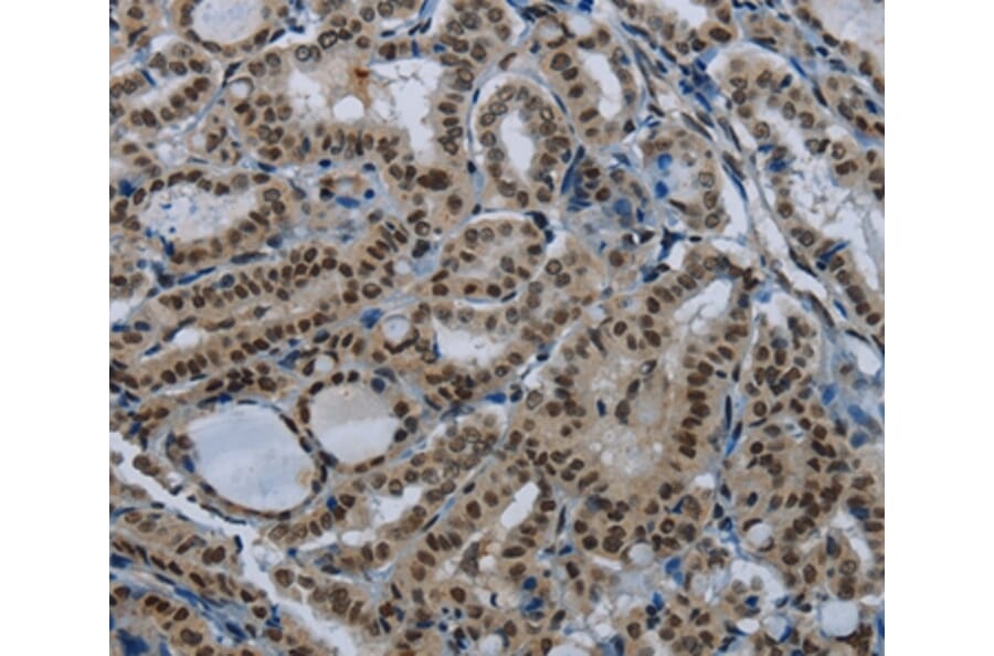 Immunohistochemistry - NBL1 Antibody from Signalway Antibody (36632) - Antibodies.com
