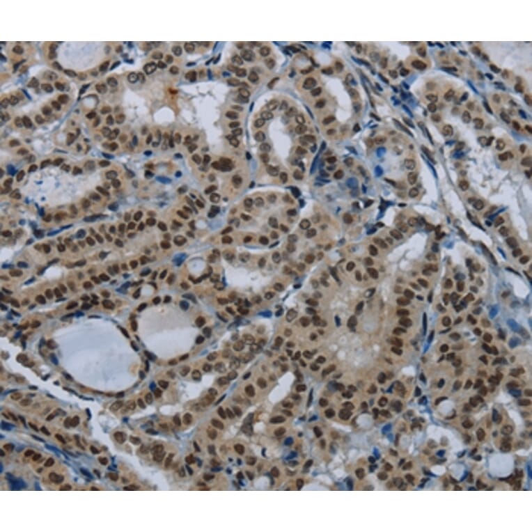 Immunohistochemistry - NBL1 Antibody from Signalway Antibody (36632) - Antibodies.com