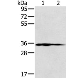 NIT1 Antibody from Signalway Antibody (36652) - Antibodies.com