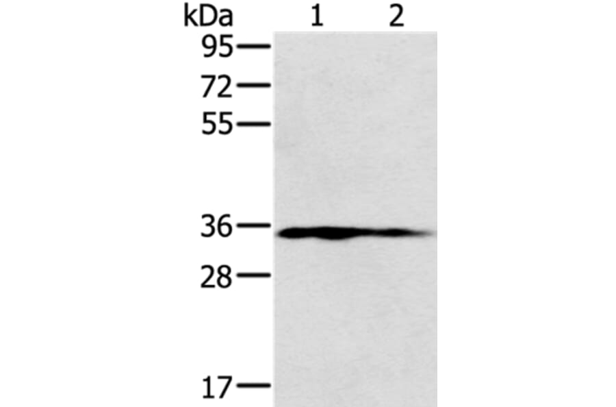 NIT1 Antibody from Signalway Antibody (36652) - Antibodies.com