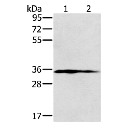 NIT1 Antibody from Signalway Antibody (36652) - Antibodies.com