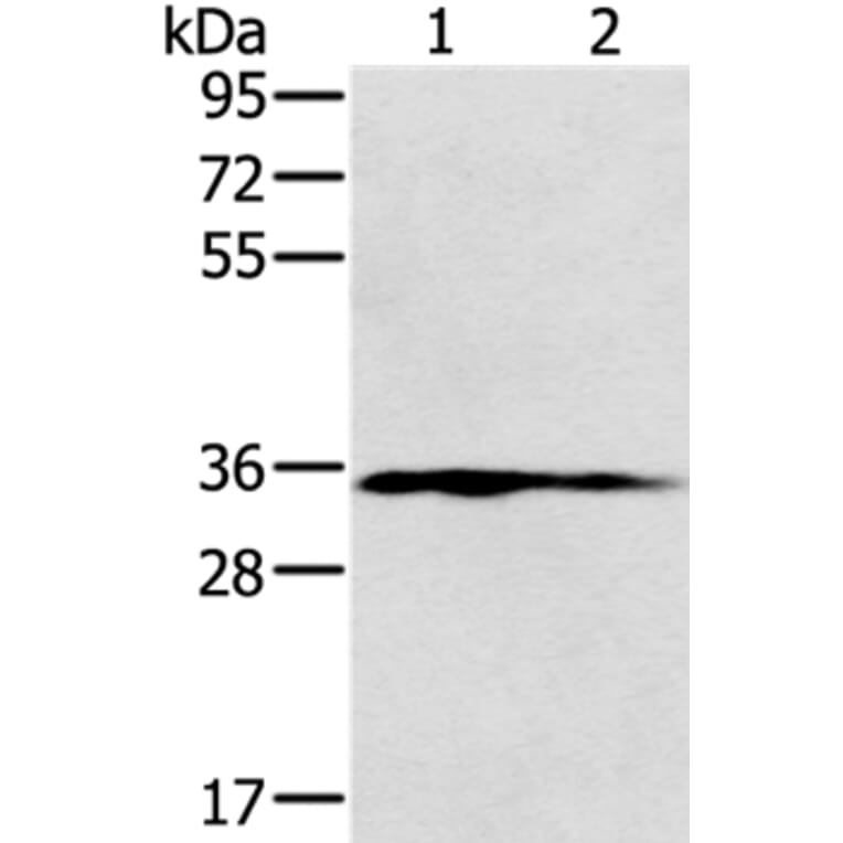 NIT1 Antibody from Signalway Antibody (36652) - Antibodies.com
