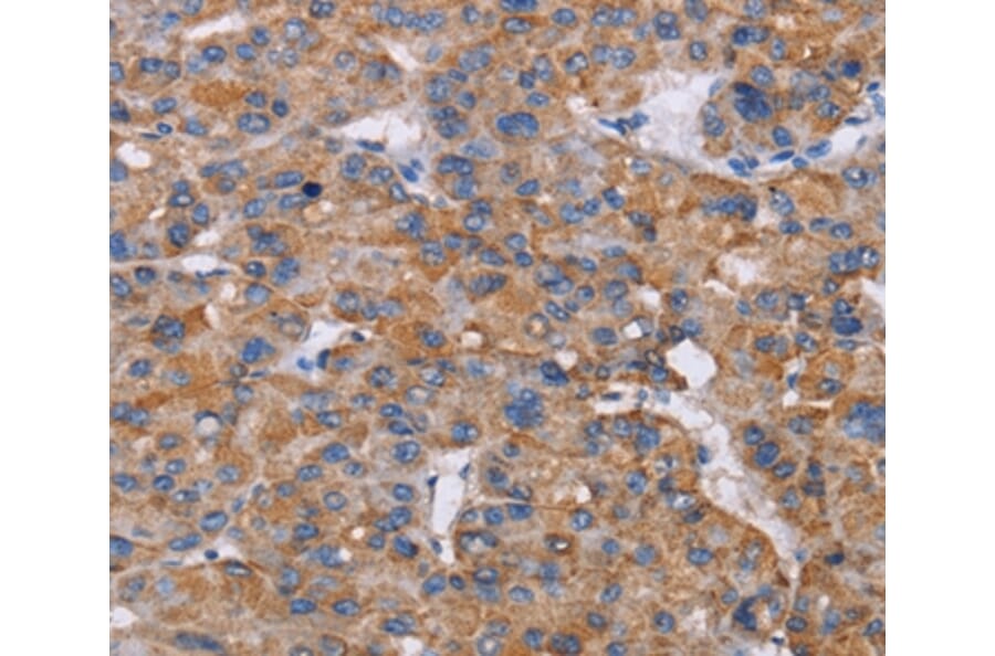 Immunohistochemistry - NIT1 Antibody from Signalway Antibody (36652) - Antibodies.com