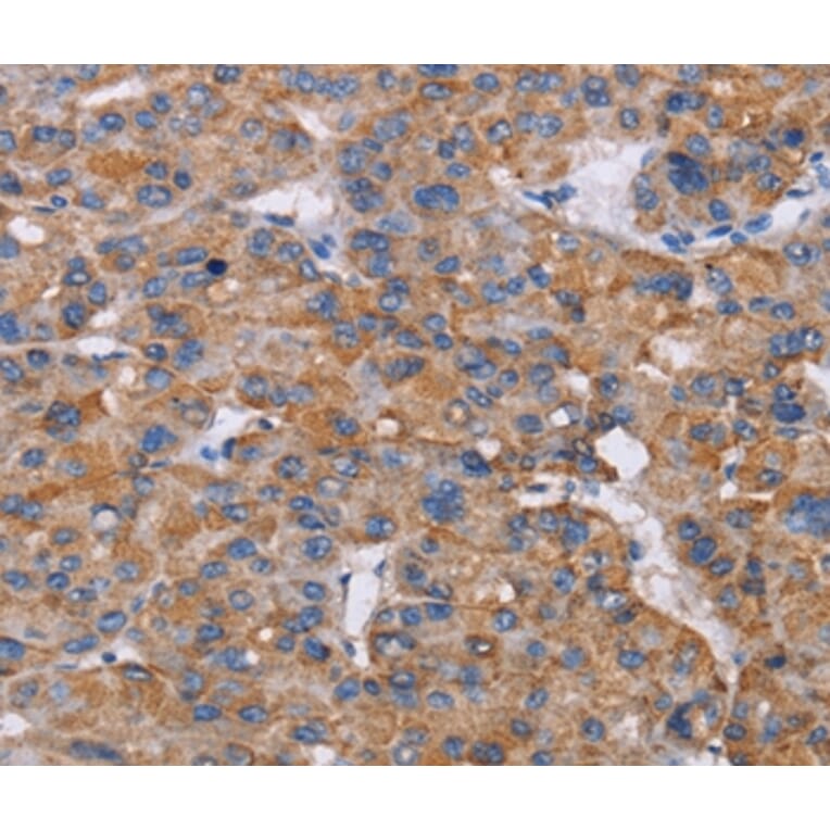 Immunohistochemistry - NIT1 Antibody from Signalway Antibody (36652) - Antibodies.com