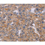 Immunohistochemistry - NIT1 Antibody from Signalway Antibody (36652) - Antibodies.com