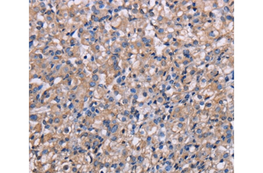 Immunohistochemistry - NIT1 Antibody from Signalway Antibody (36652) - Antibodies.com