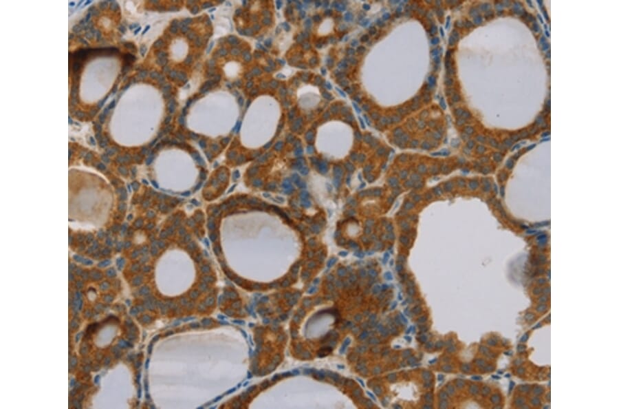 Immunohistochemistry - PARL Antibody from Signalway Antibody (36682) - Antibodies.com