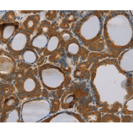 Immunohistochemistry - PARL Antibody from Signalway Antibody (36682) - Antibodies.com