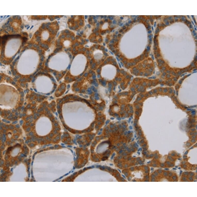 Immunohistochemistry - PARL Antibody from Signalway Antibody (36682) - Antibodies.com