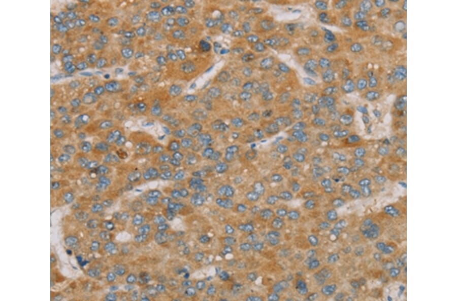 Immunohistochemistry - PARL Antibody from Signalway Antibody (36682) - Antibodies.com