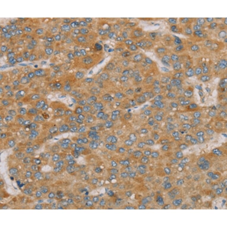 Immunohistochemistry - PARL Antibody from Signalway Antibody (36682) - Antibodies.com