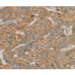 Immunohistochemistry - PARL Antibody from Signalway Antibody (36682) - Antibodies.com