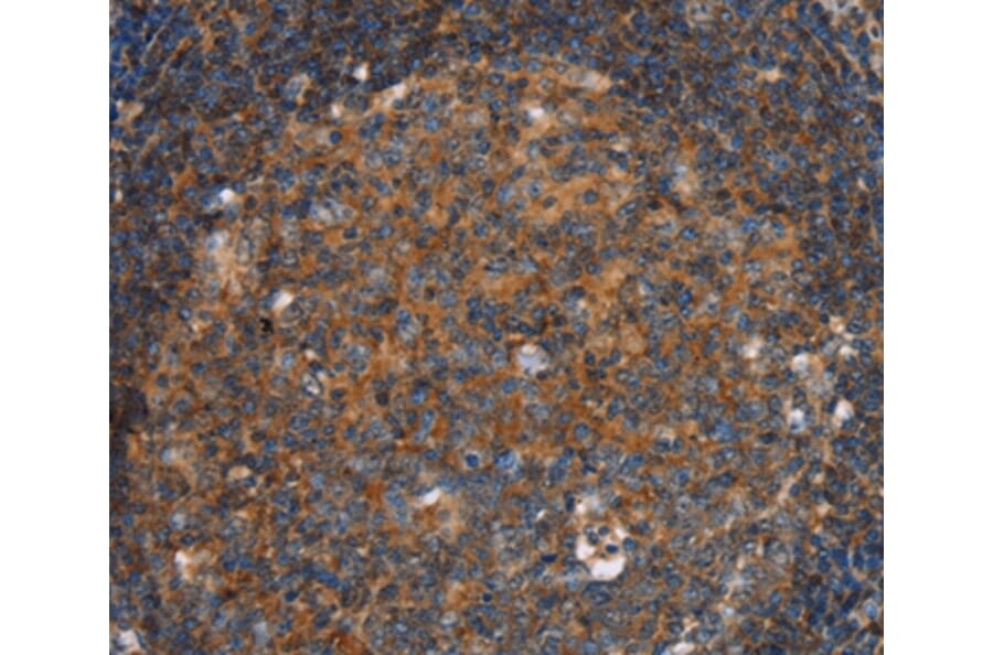 Immunohistochemistry - PFKL Antibody from Signalway Antibody (36691) - Antibodies.com