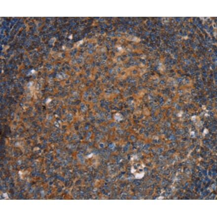 Immunohistochemistry - PFKL Antibody from Signalway Antibody (36691) - Antibodies.com