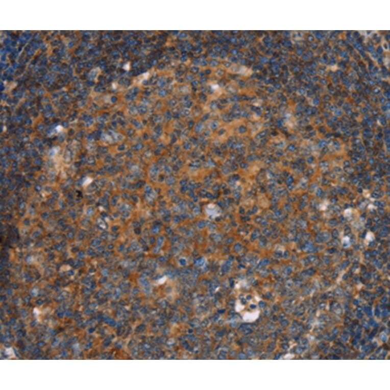 Immunohistochemistry - PFKL Antibody from Signalway Antibody (36691) - Antibodies.com