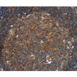 Immunohistochemistry - PFKL Antibody from Signalway Antibody (36691) - Antibodies.com