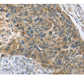 Immunohistochemistry - PHKB Antibody from Signalway Antibody (36692) - Antibodies.com