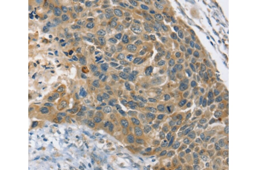 Immunohistochemistry - PHKB Antibody from Signalway Antibody (36692) - Antibodies.com
