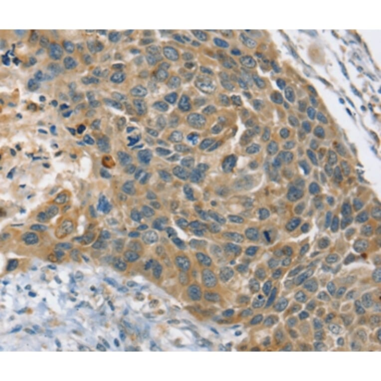 Immunohistochemistry - PHKB Antibody from Signalway Antibody (36692) - Antibodies.com