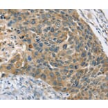 Immunohistochemistry - PHKB Antibody from Signalway Antibody (36692) - Antibodies.com